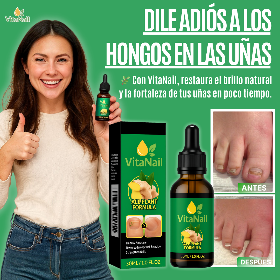 VITANAIL | TRATAMIENTO ANTI HONGOS 7 DÍAS 100% NATURAL