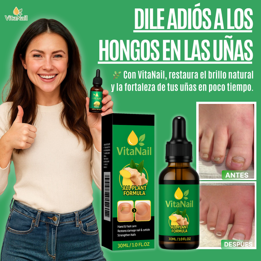 VITANAIL | TRATAMIENTO ANTI HONGOS 7 DÍAS 100% NATURAL