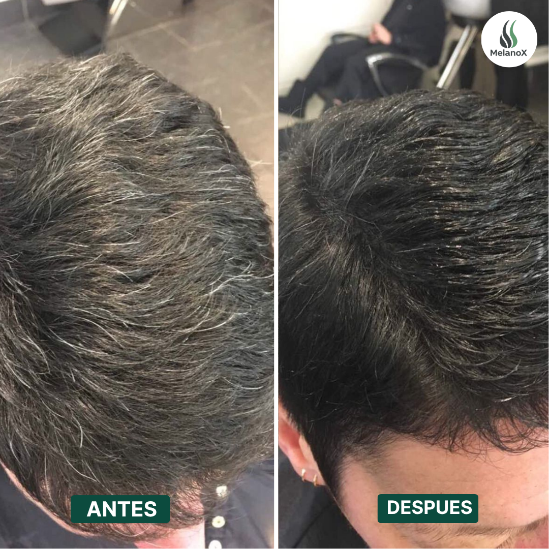 MELANOX | SHAMPOO ANTICANAS + 2 REGALOS EXCLUSIVOS