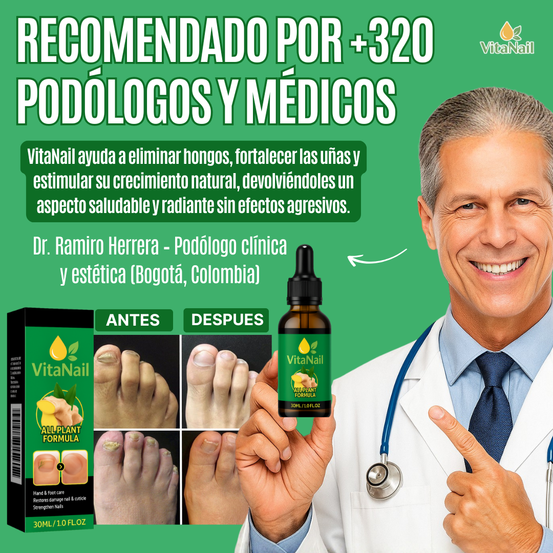 VITANAIL | TRATAMIENTO ANTI HONGOS 7 DÍAS 100% NATURAL