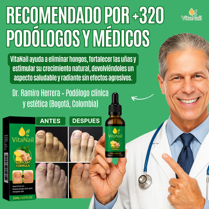 VITANAIL | TRATAMIENTO ANTI HONGOS 7 DÍAS 100% NATURAL